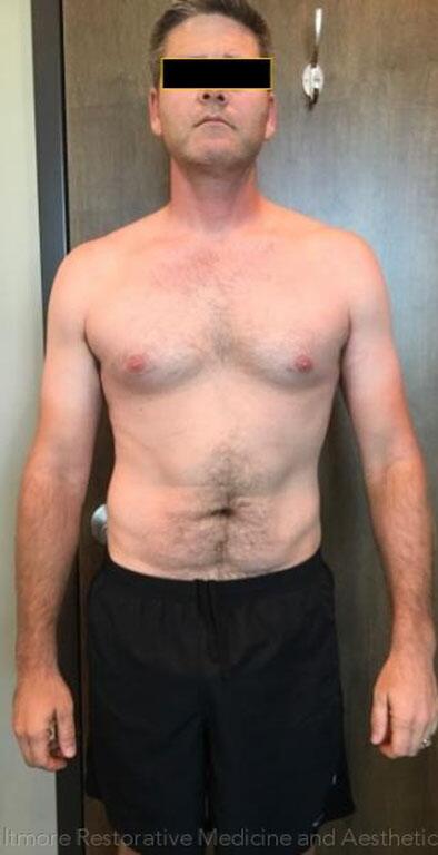 Man before hormone and peptide therapy