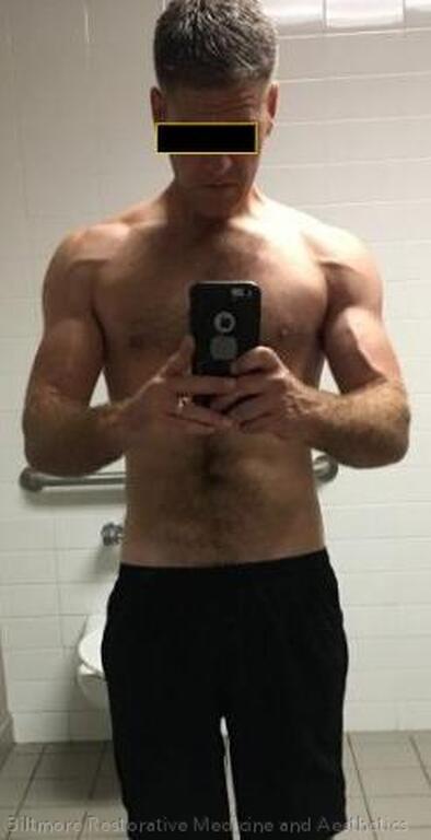 Man after hormone and peptide therapy